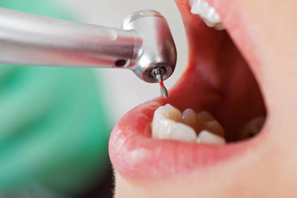 Best Emergency Tooth Extraction in Prospect Park, NJ